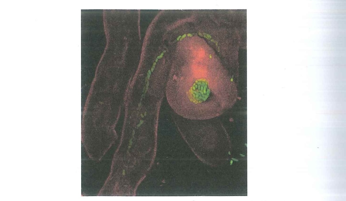 dettaglio-endosimbiosi-articolo-batteri-azotofissatori.jpg